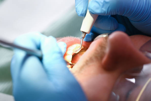 Best Emergency Cosmetic Dentistry in Spencerville, OH