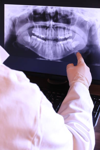 Best Mobile Emergency Dentist in Spencerville, OH