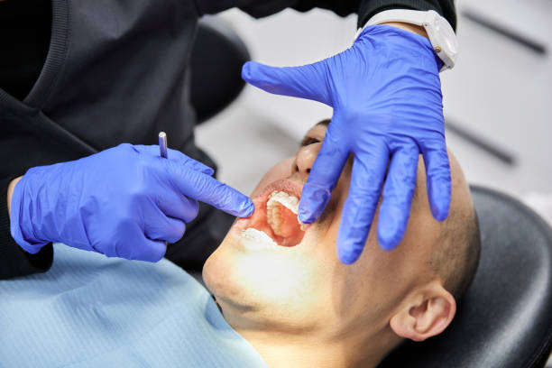 Best Emergency Root Canal Treatment in Spencerville, OH